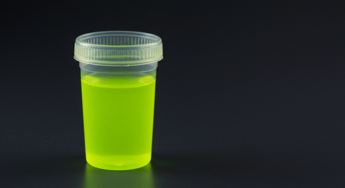 urine jaune fluo