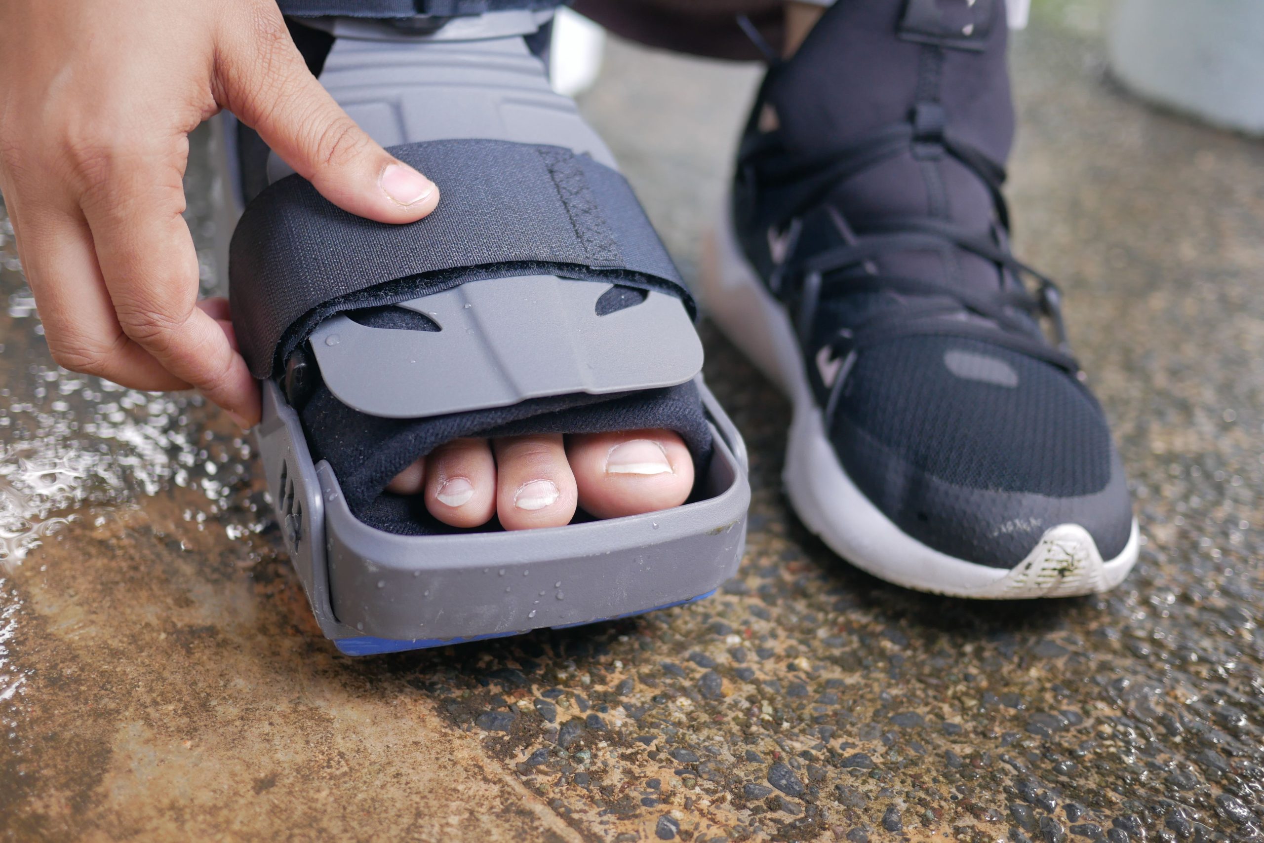 Pied dans une attelle orthopédique de récupération