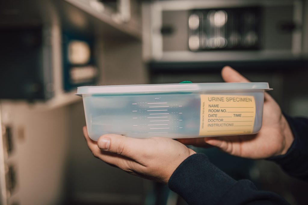 Mains tenant un flacon d'analyse d'urine en laboratoire
