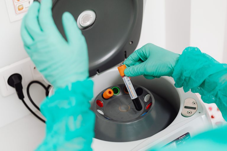 Technicien de laboratoire analysant un échantillon sanguin
